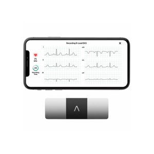 ECG KardiaMobile 6 pistes